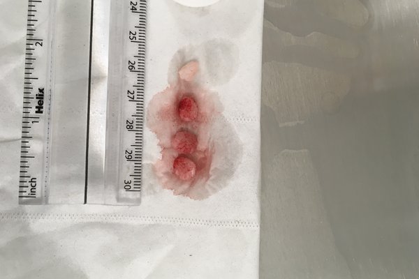 Bladder Stones In Cats