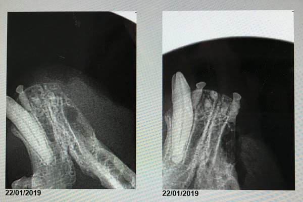 Dental X rays - After