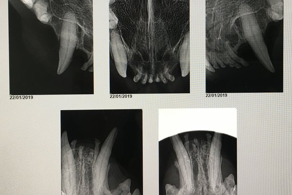 Dental X rays - Before