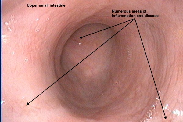 Endoscopy image 1
