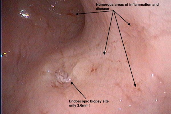 Endoscopy image