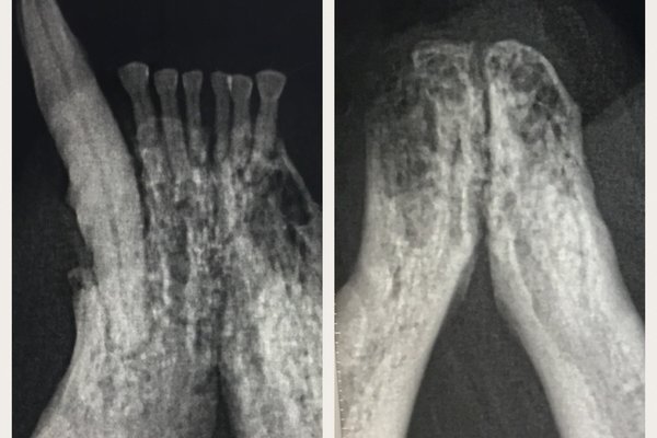 Before and after X rays